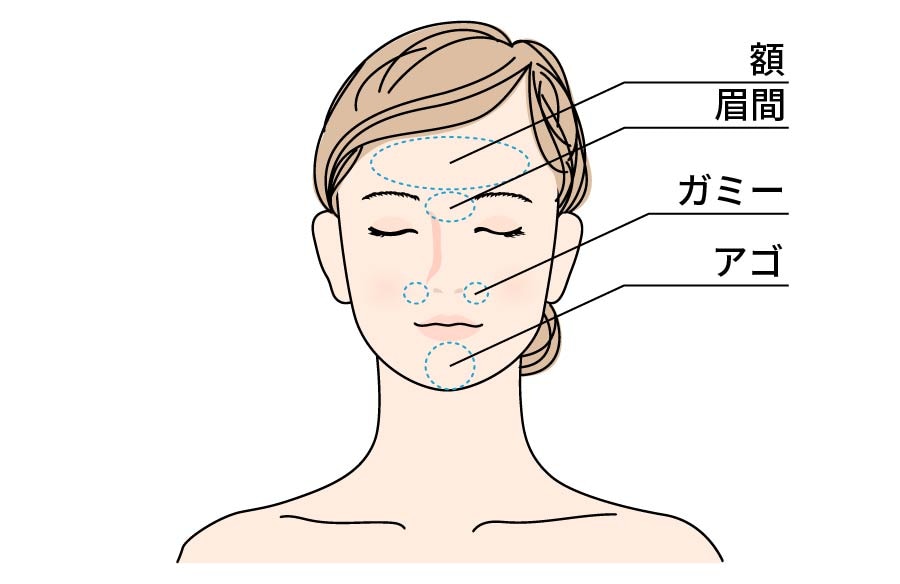 今回選んだのは「よくばり4か所」