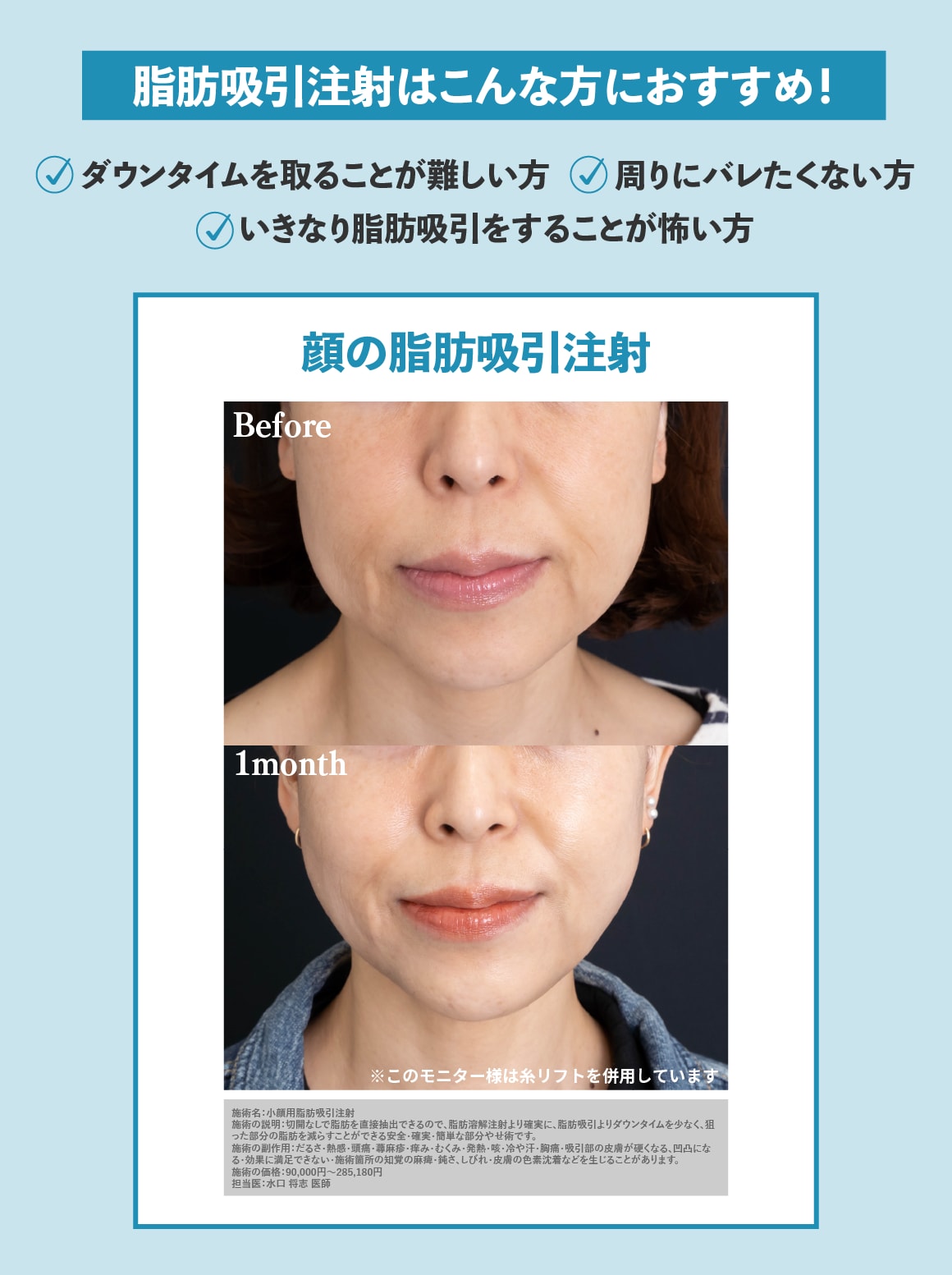 脂肪吸引注射