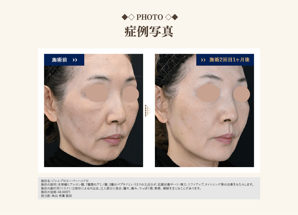症例紹介