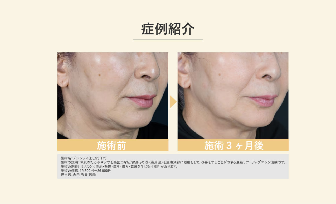 症例紹介