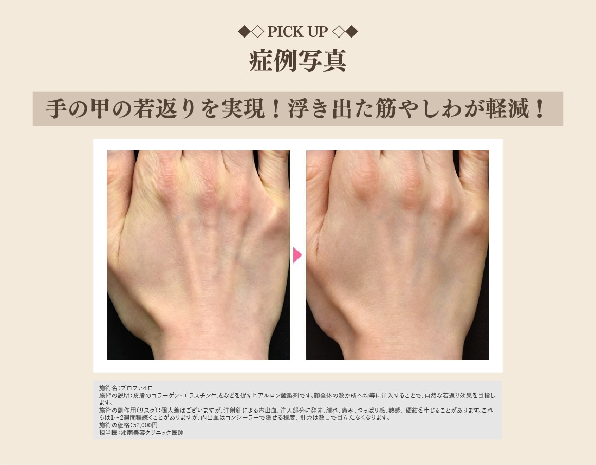症例紹介