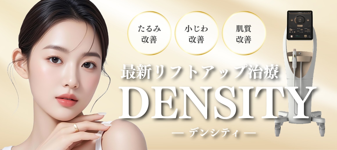 デンシティとは？