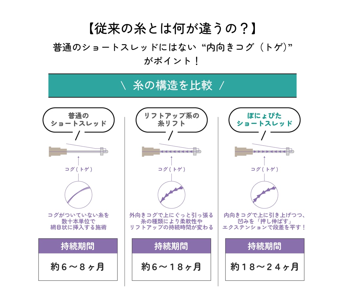 従来の糸とは何が違うの？