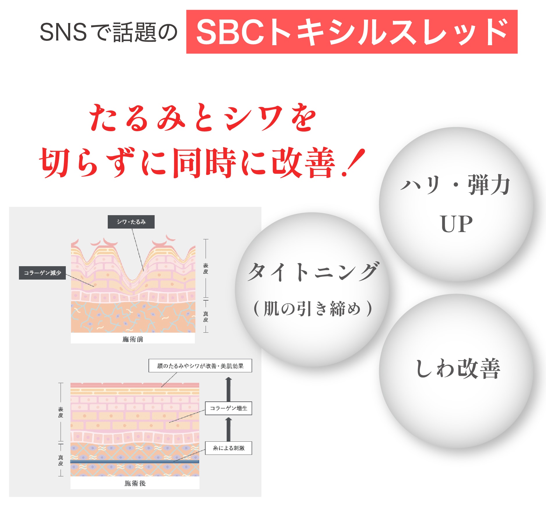 SBCトキシルスレッドとは？