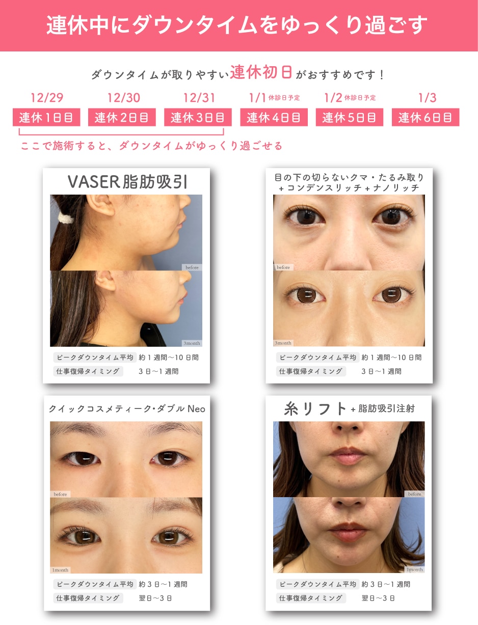 ダウンタイム目安