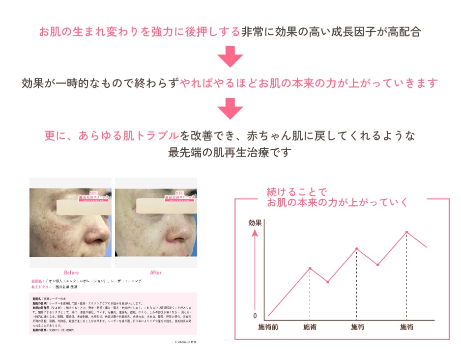 ベビースキンが人気の理由