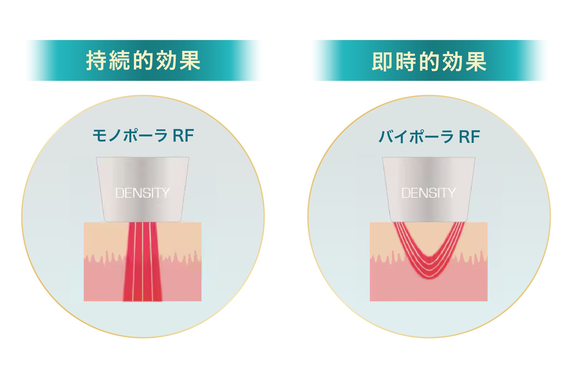 デンシティの最大の特徴【モノバイ技術】