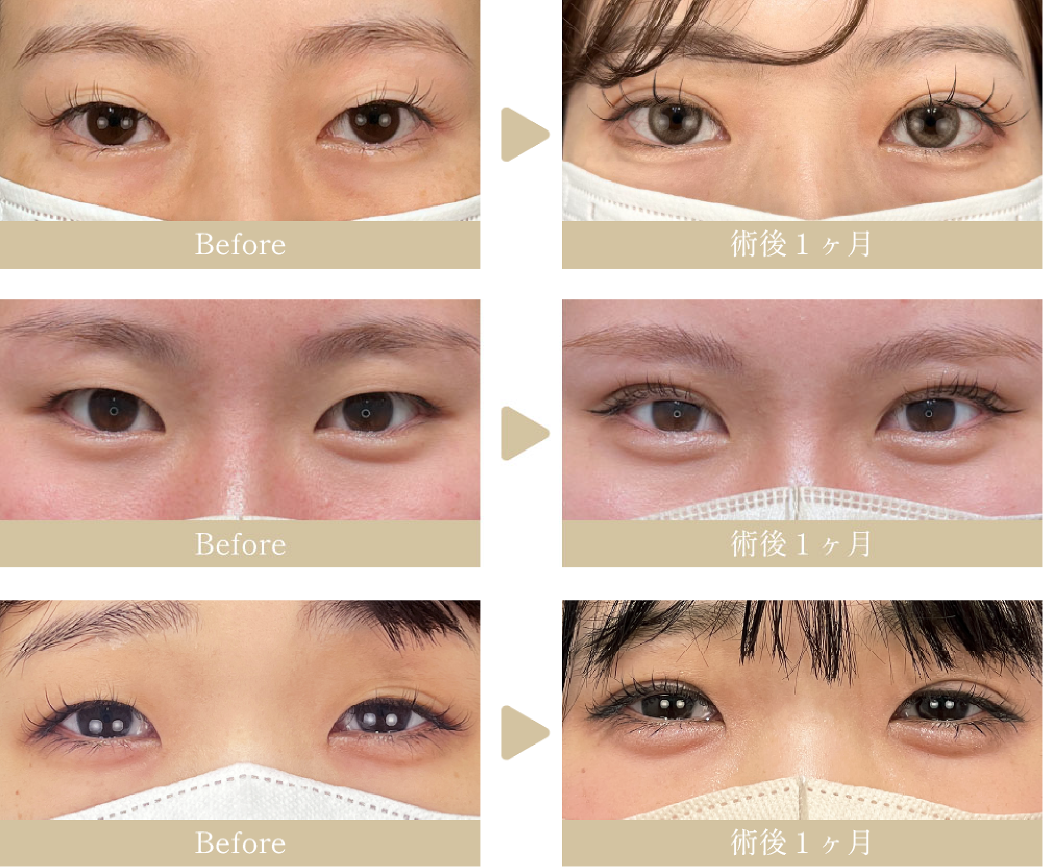 20代女性　クイックコスメティーク・ダブル