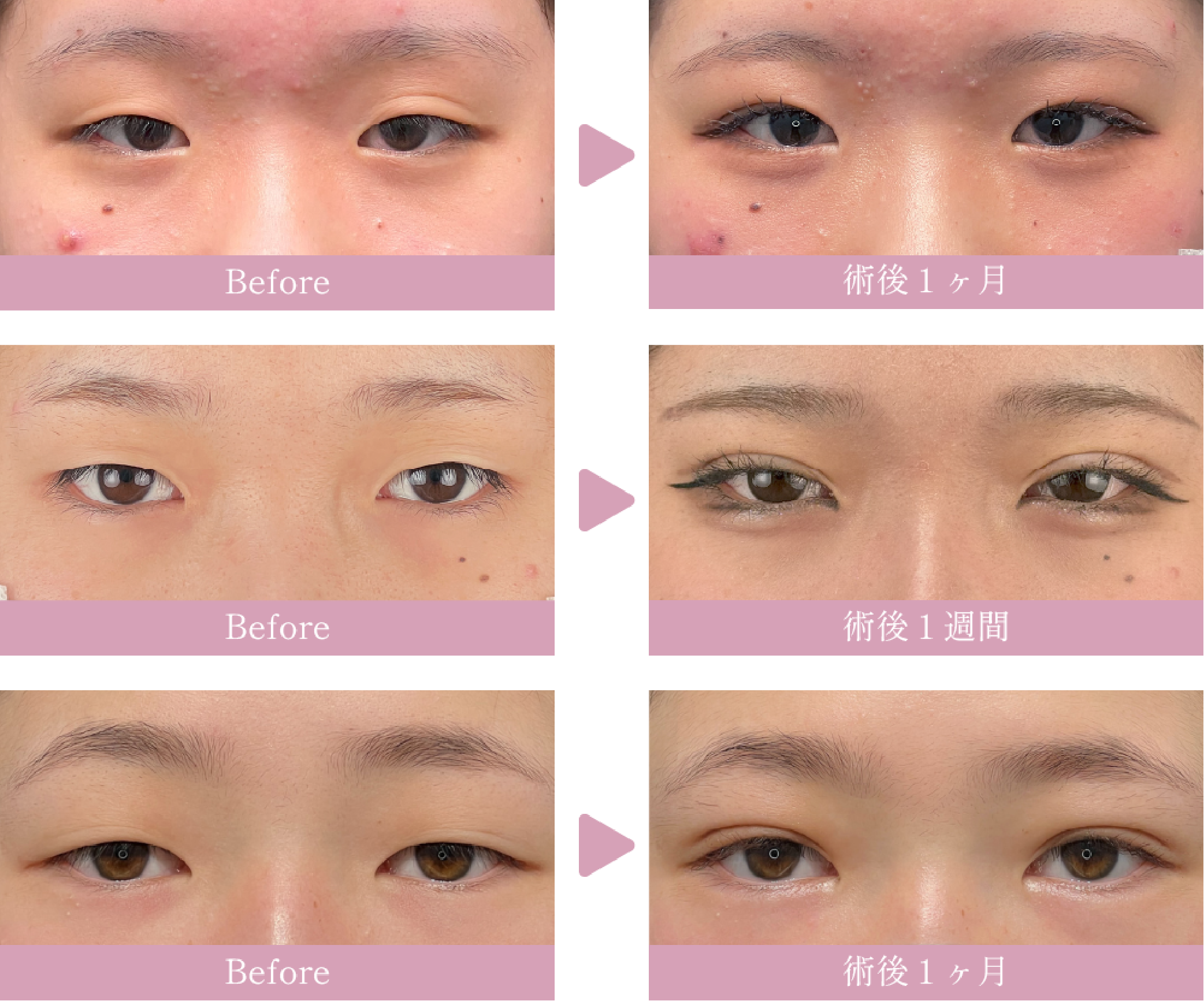 10代女性　クイックコスメティーク・ダブル