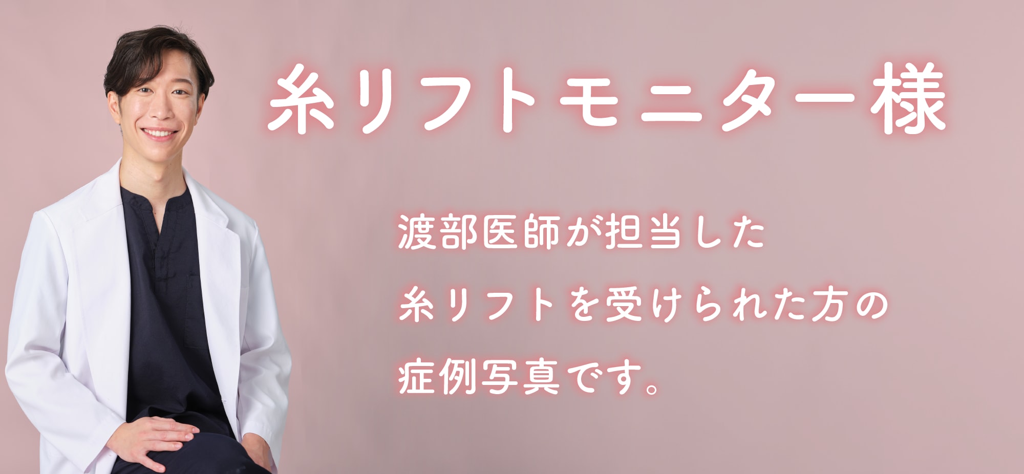 糸リフトを受けられたモニター様の症例写真です