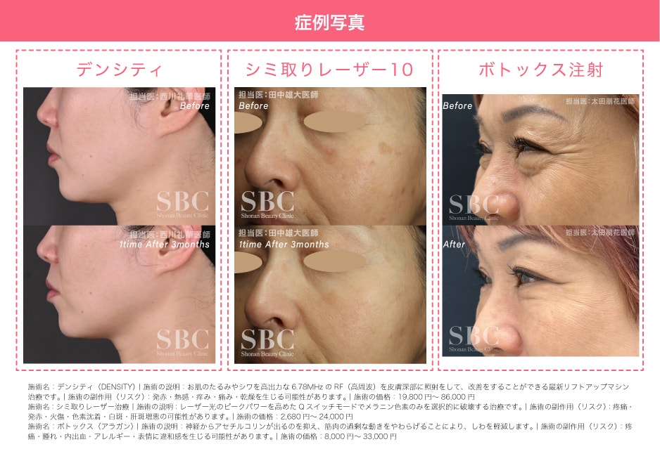 当院の施術実績と肌管理による変化