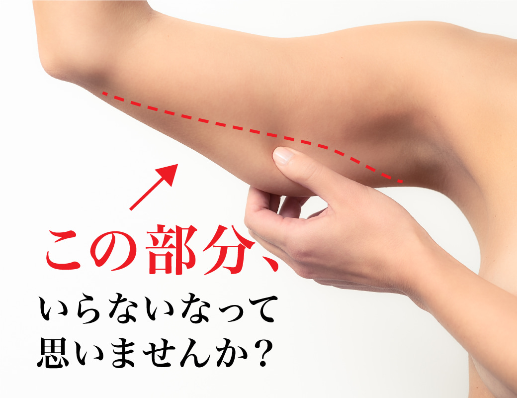 【脂肪吸引】二の腕モニター募集開始