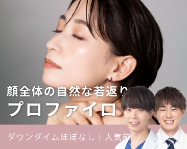 プロファイロ