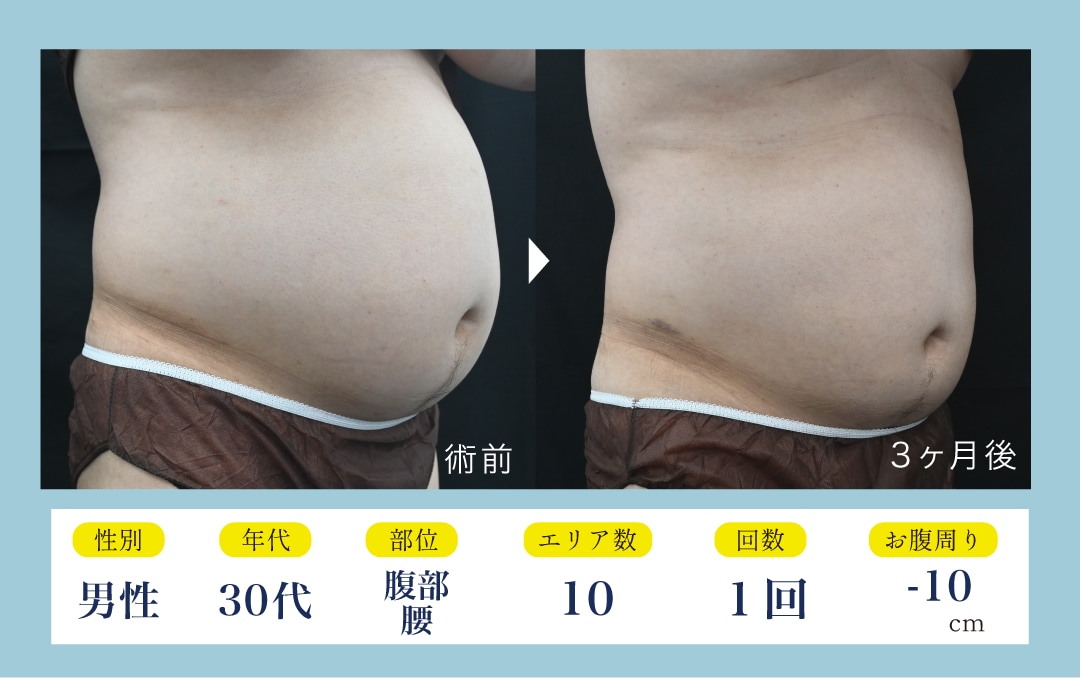 人気部位別症例紹介