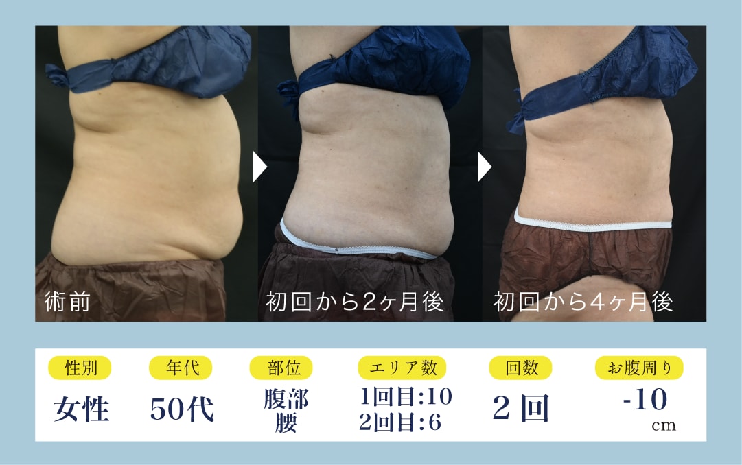10エリアモニター様症例紹介