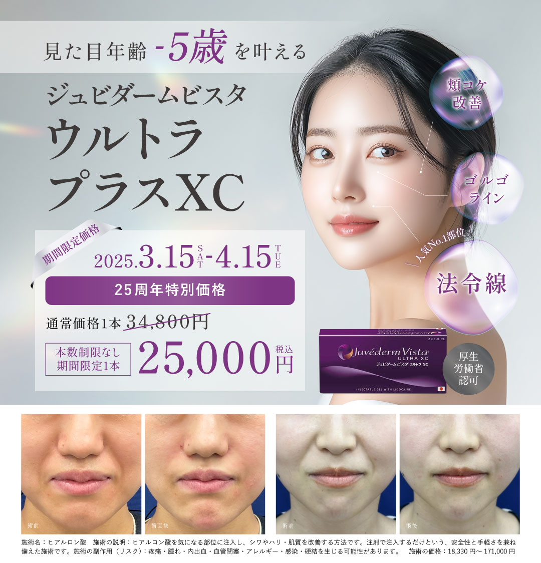 25周年記念特別価格
