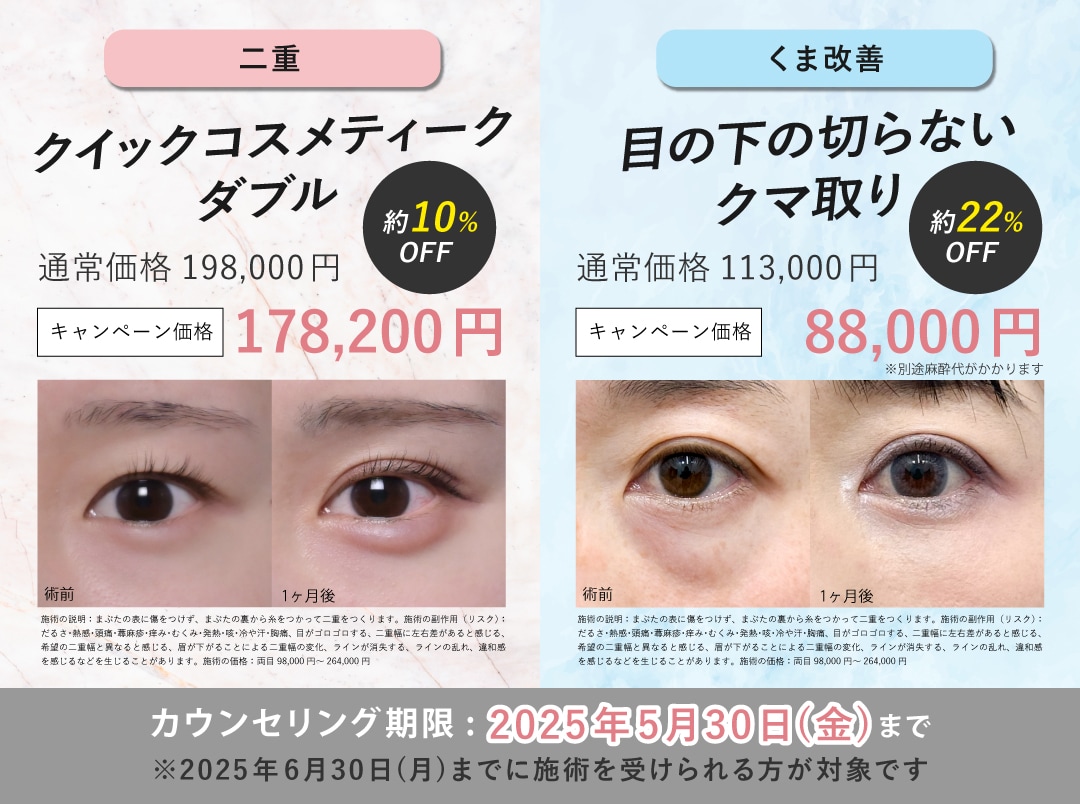 二重施術・クマ取りのお得なキャンペーン