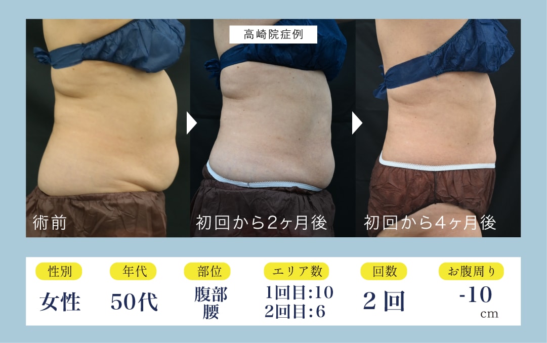 10エリアモニター様症例紹介