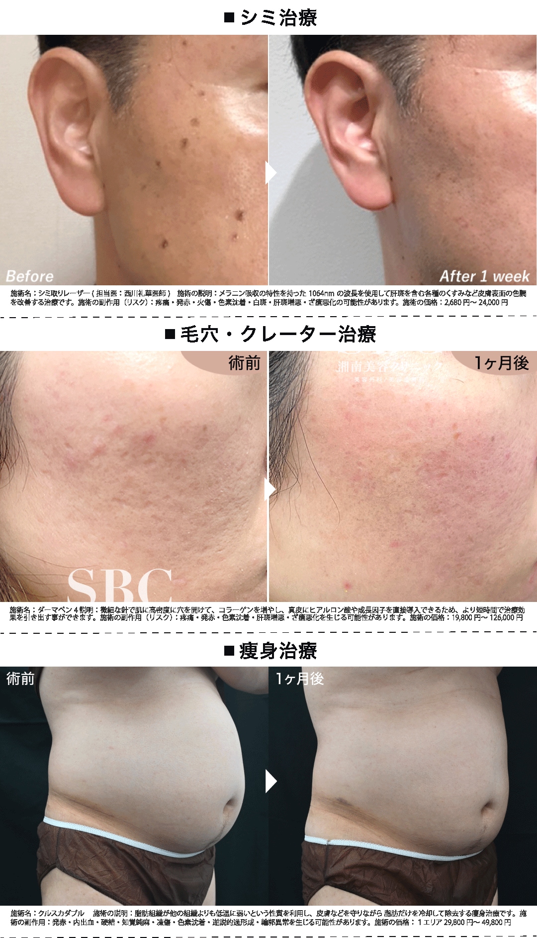 美容皮膚科・痩身治療・ワキ汗治療