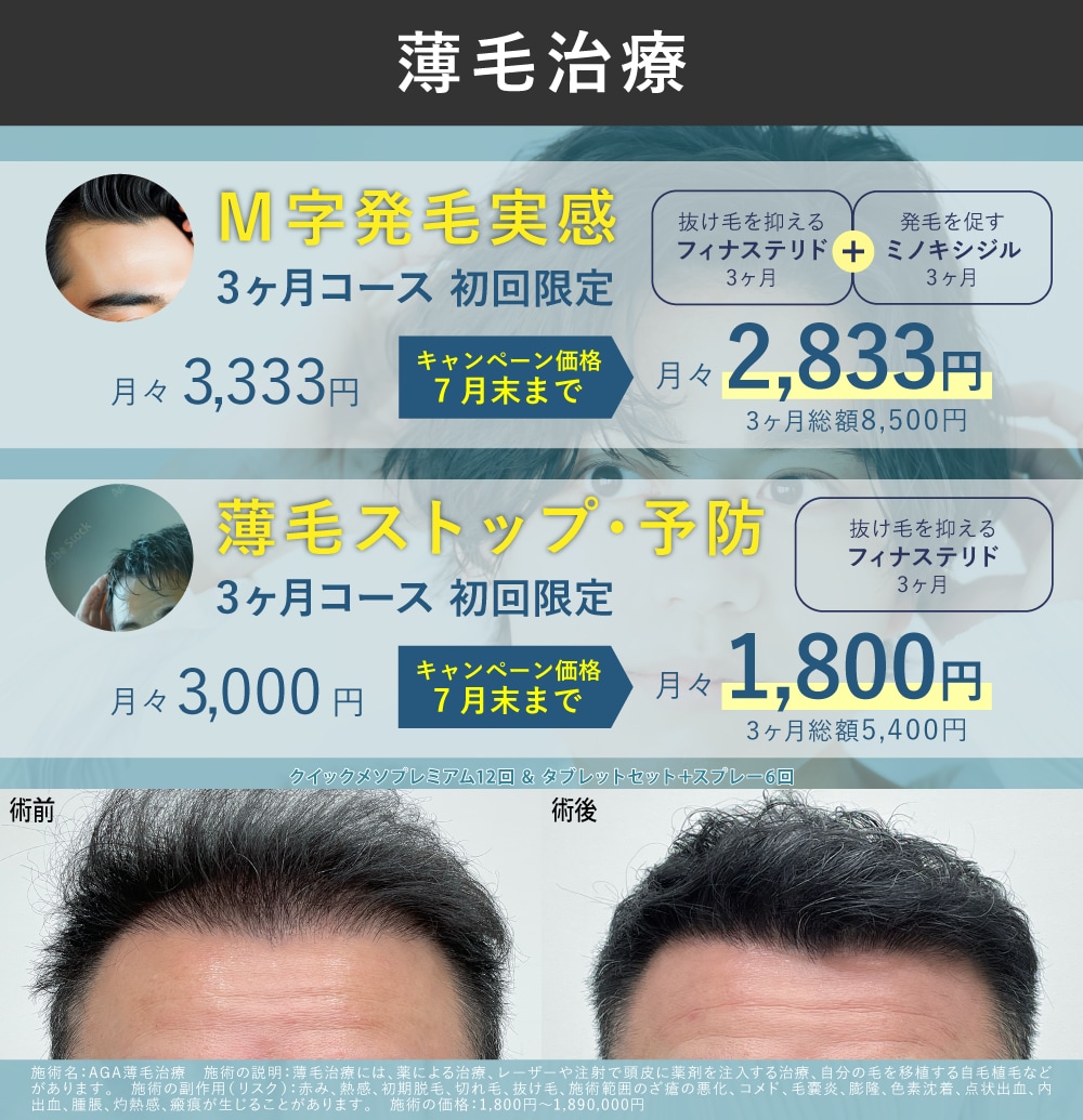 薄毛治療