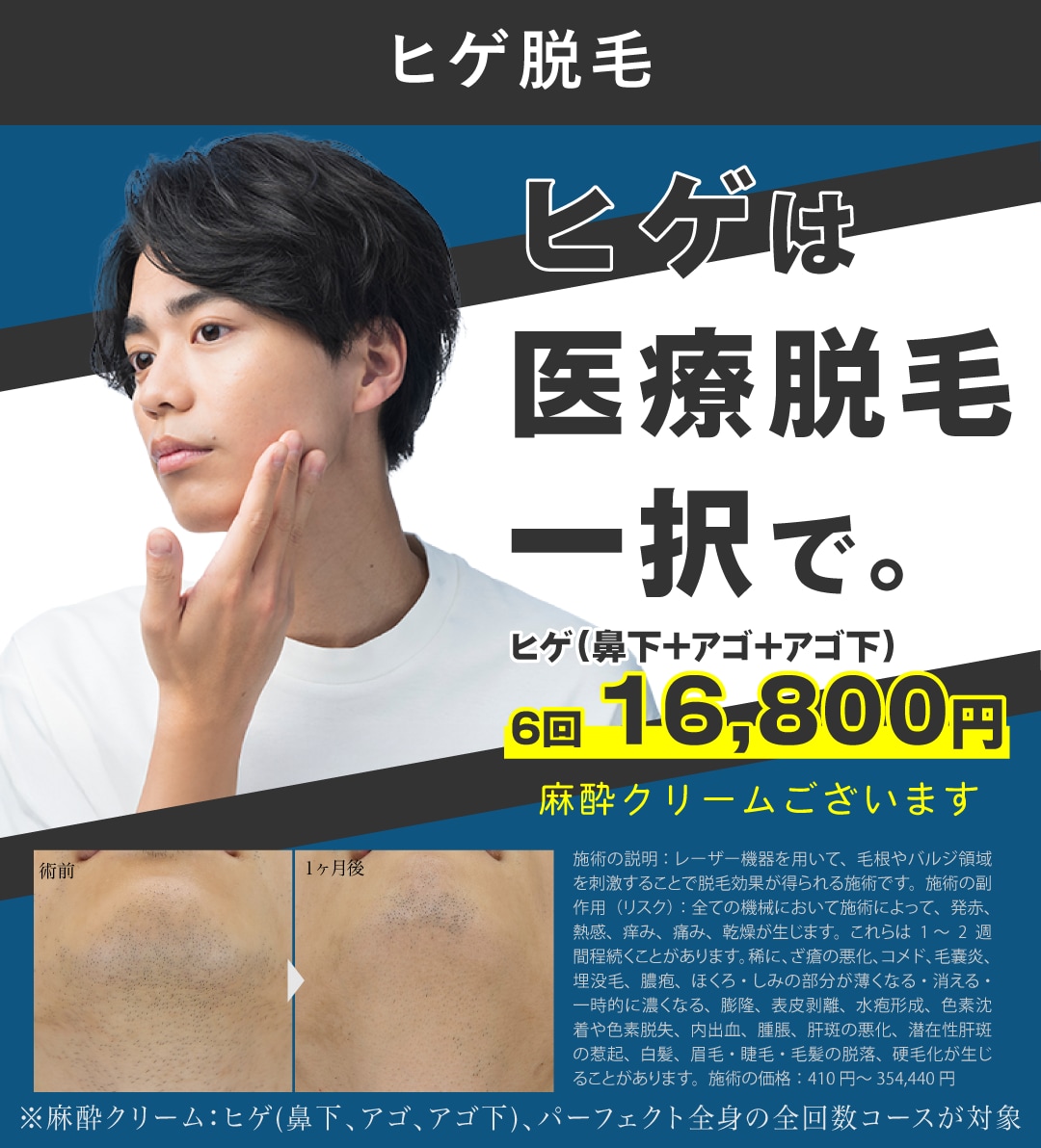 ヒゲの医療脱毛
