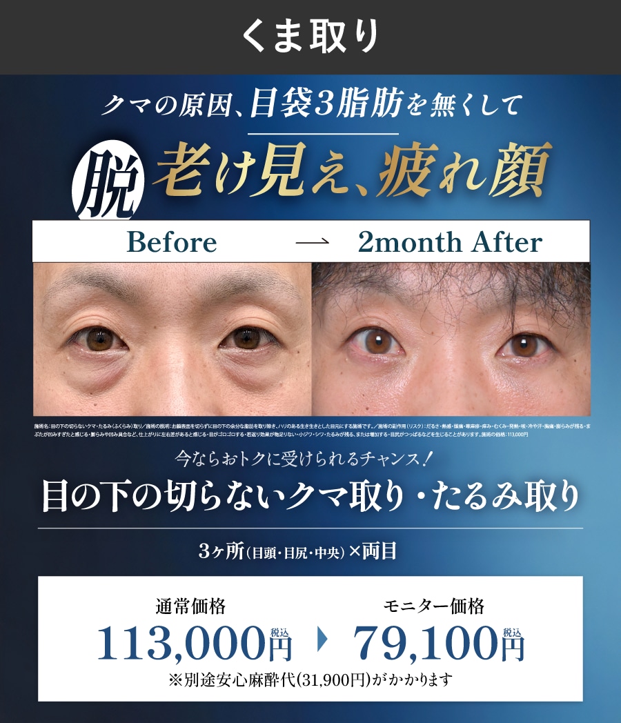クマ取り疲れ顔