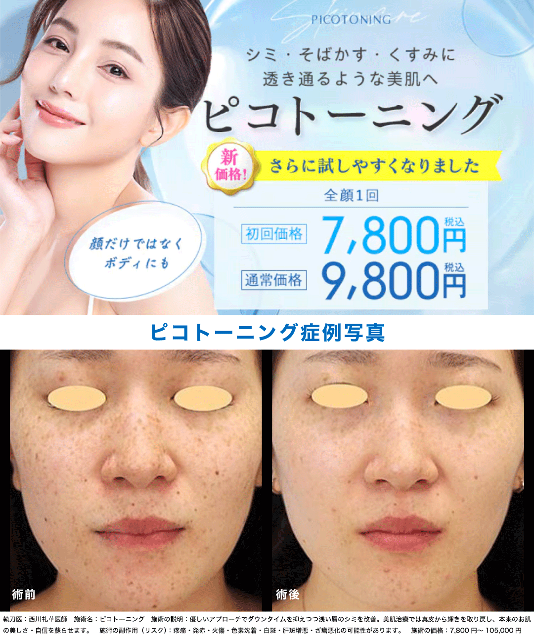 ピコトーニングってどんな効果があるの?
