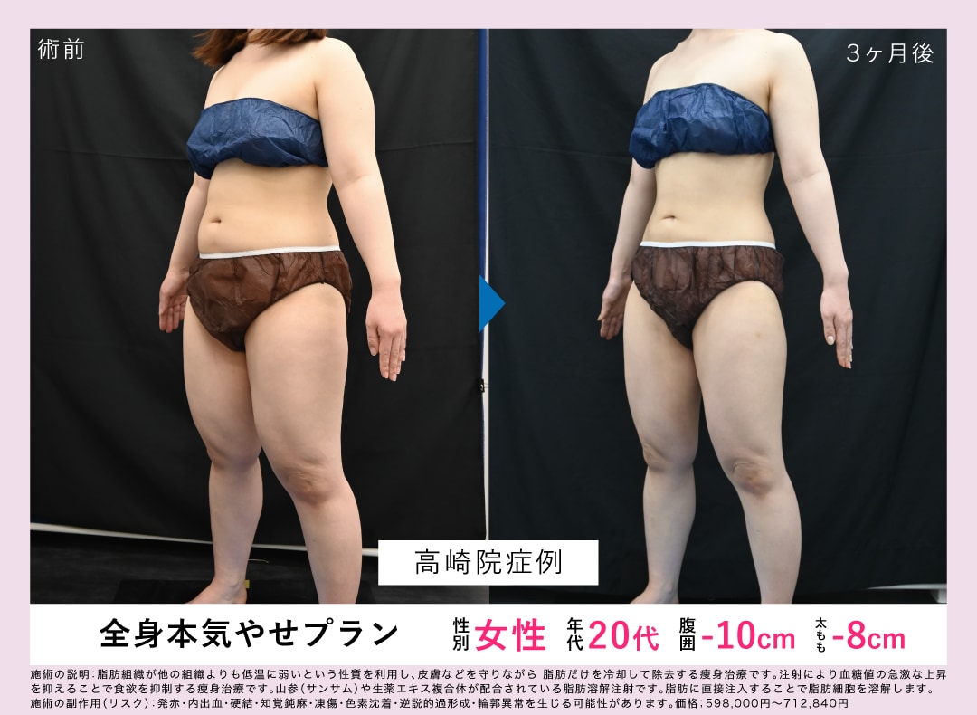 医療ダイエットのお悩み