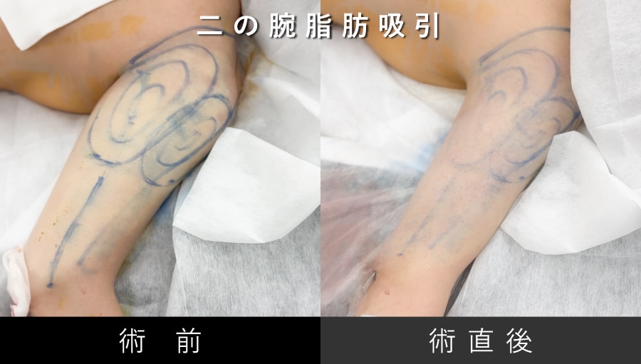 表面の脂肪を“あえて少し残す