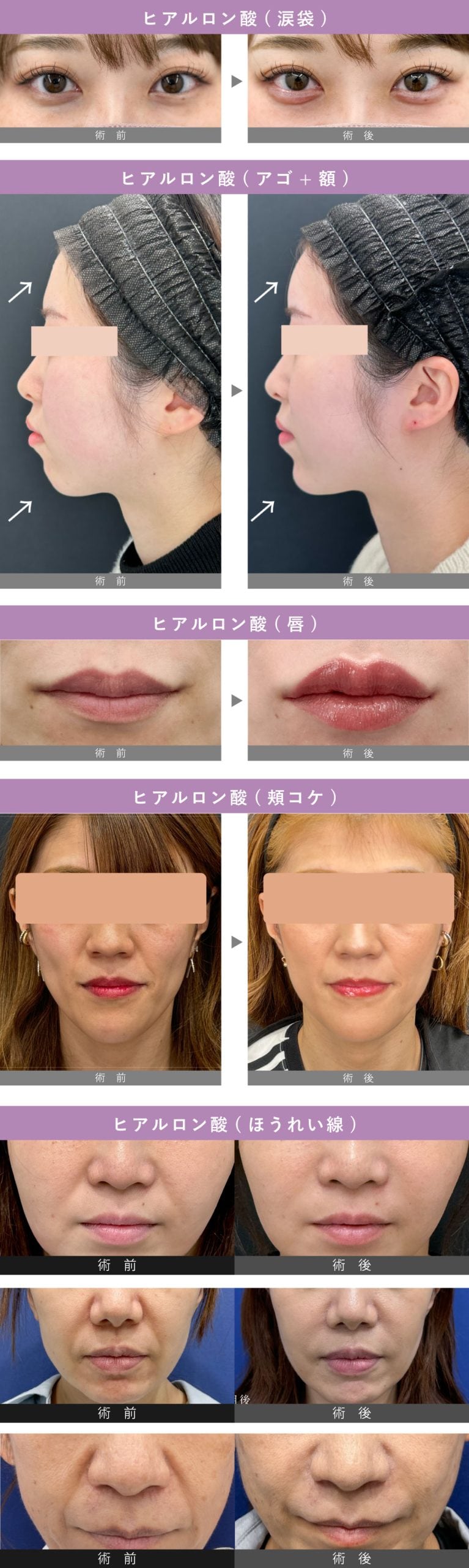 症例写真