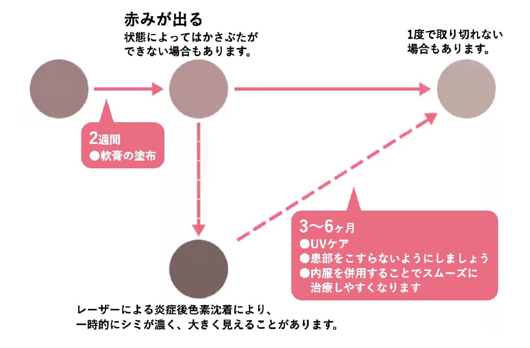 ダウンタイム中はどんな症状が出るの？