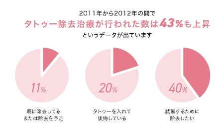 タトゥーのよくあるお悩み