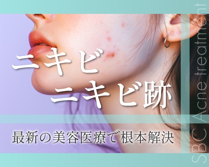 【医師解説】群馬 高崎で本気のニキビ・ニキビ跡治療｜赤み・クレーターも湘南美容クリニック高崎院で改善