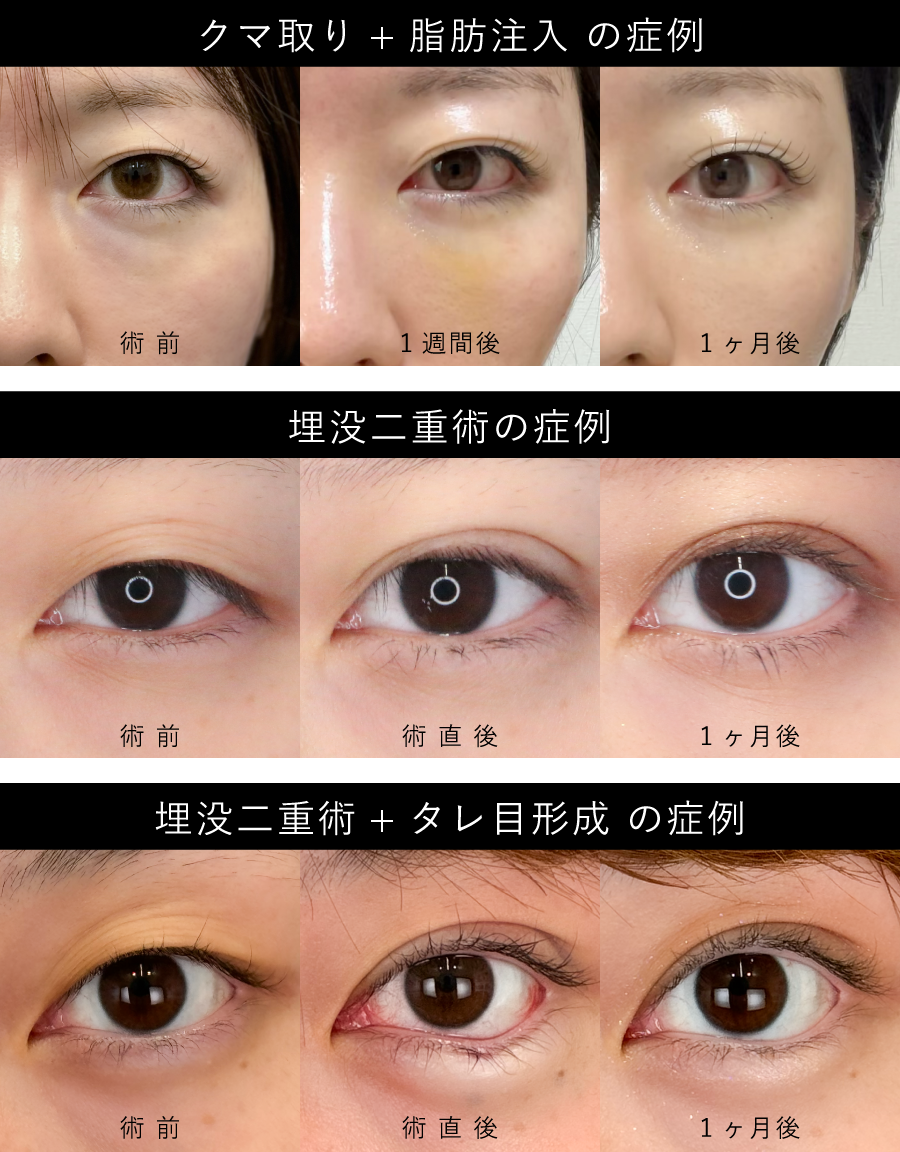 やりすぎない、整える整形