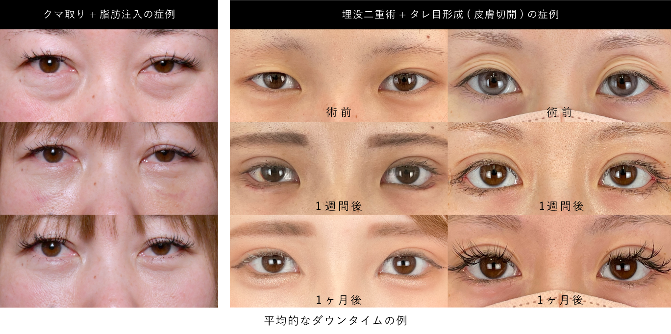 ダウンタイム最小限