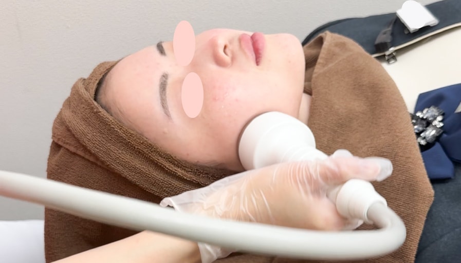 【併用オススメ治療】エレクトロポレーション