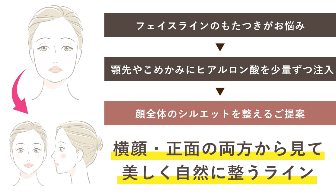 フェイスラインのもたつきでお悩みのお客様