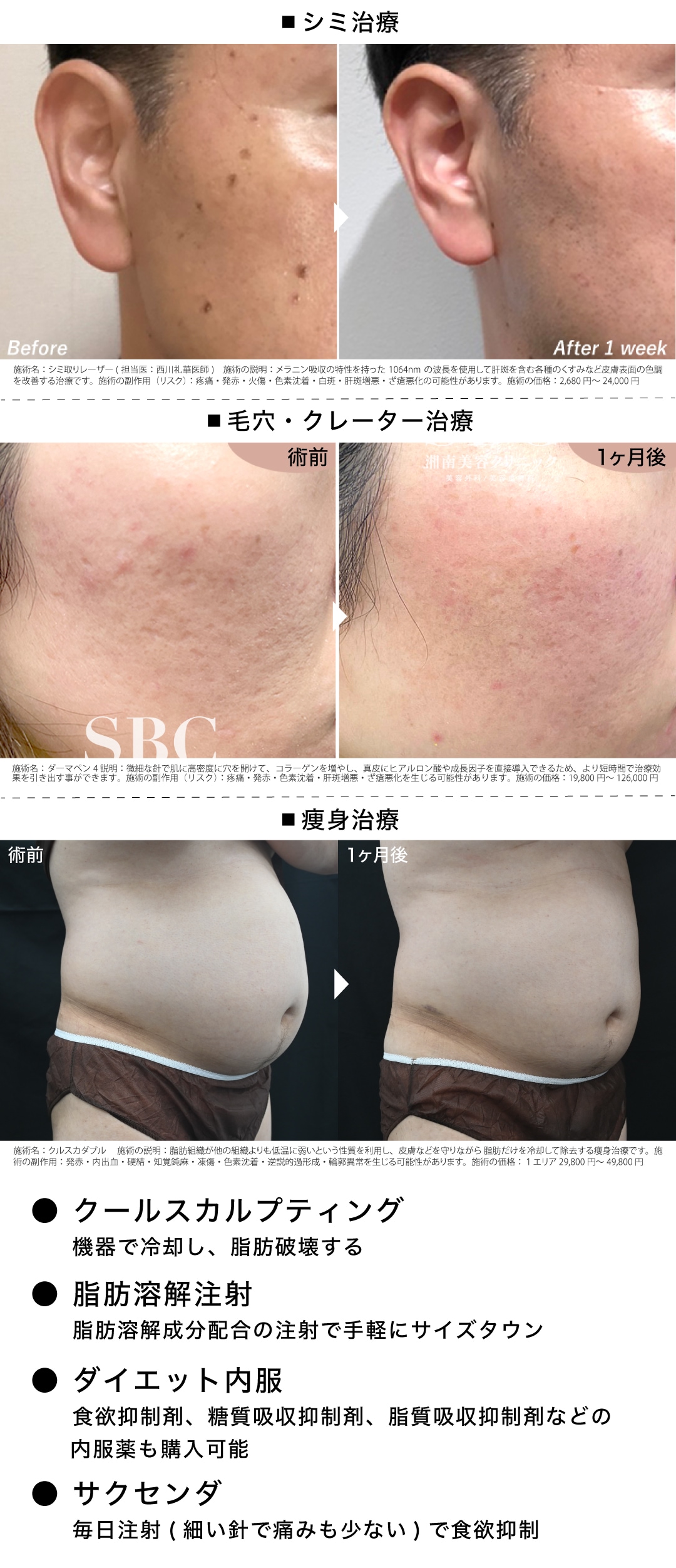 美容皮膚科・痩身治療・ワキ汗治療