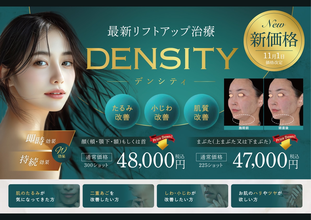 最新のRF(高周波)リフトアップマシン