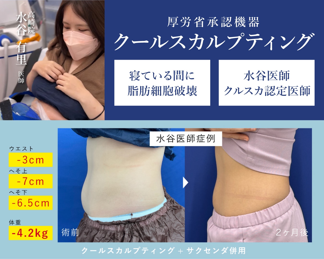 ダイエット 痩せ 脂肪燃焼 脂肪溶解 美容医療 エステ 脂肪 撃退 
