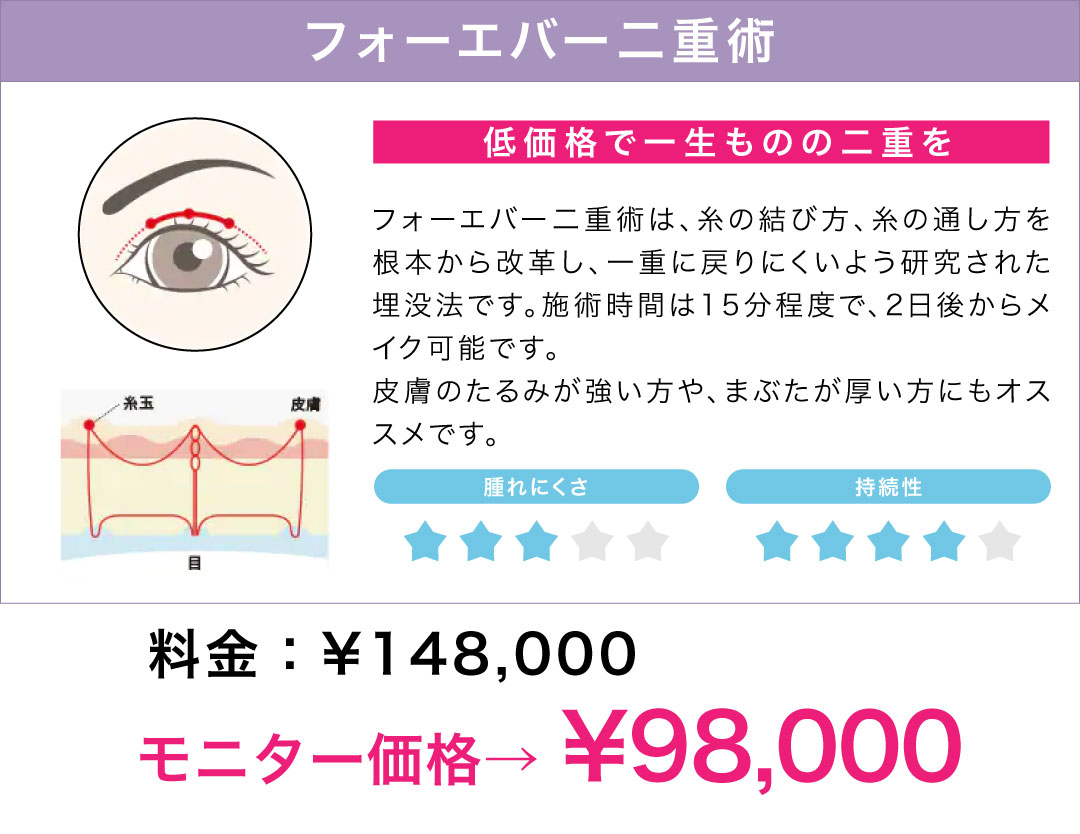 フォーエバー二重術