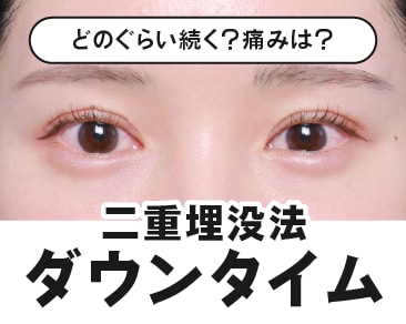 【二重埋没ダウンタイム】二重整形の経過紹介!腫れや内出血について徹底解説!【湘南美容クリニック高崎院】