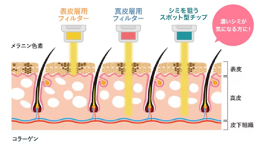 フォトトリプルとは？
