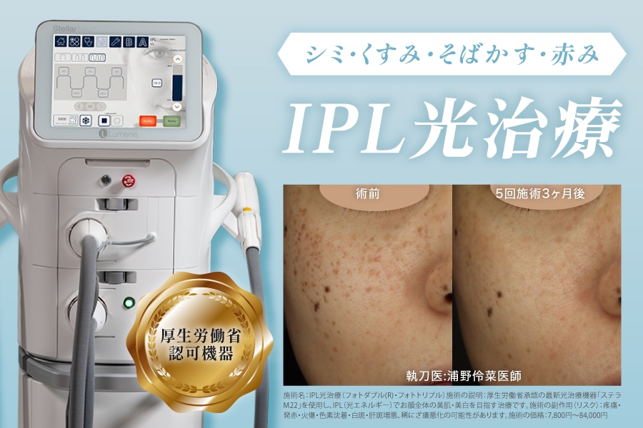 IPL光治療とは