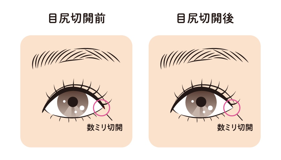 目の横幅を広げる