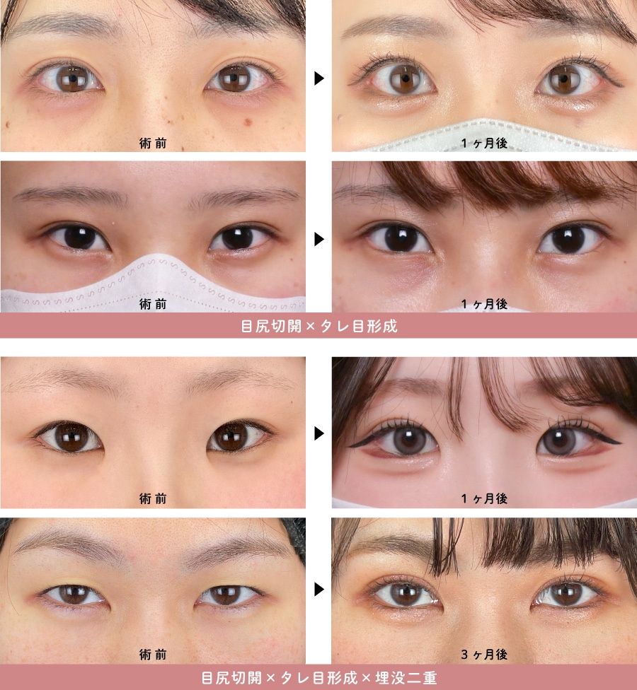 高崎院で人気の組み合わせ症例（ビフォーアフター）