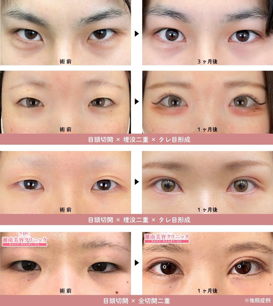 高崎院での症例実績（ビフォーアフター）