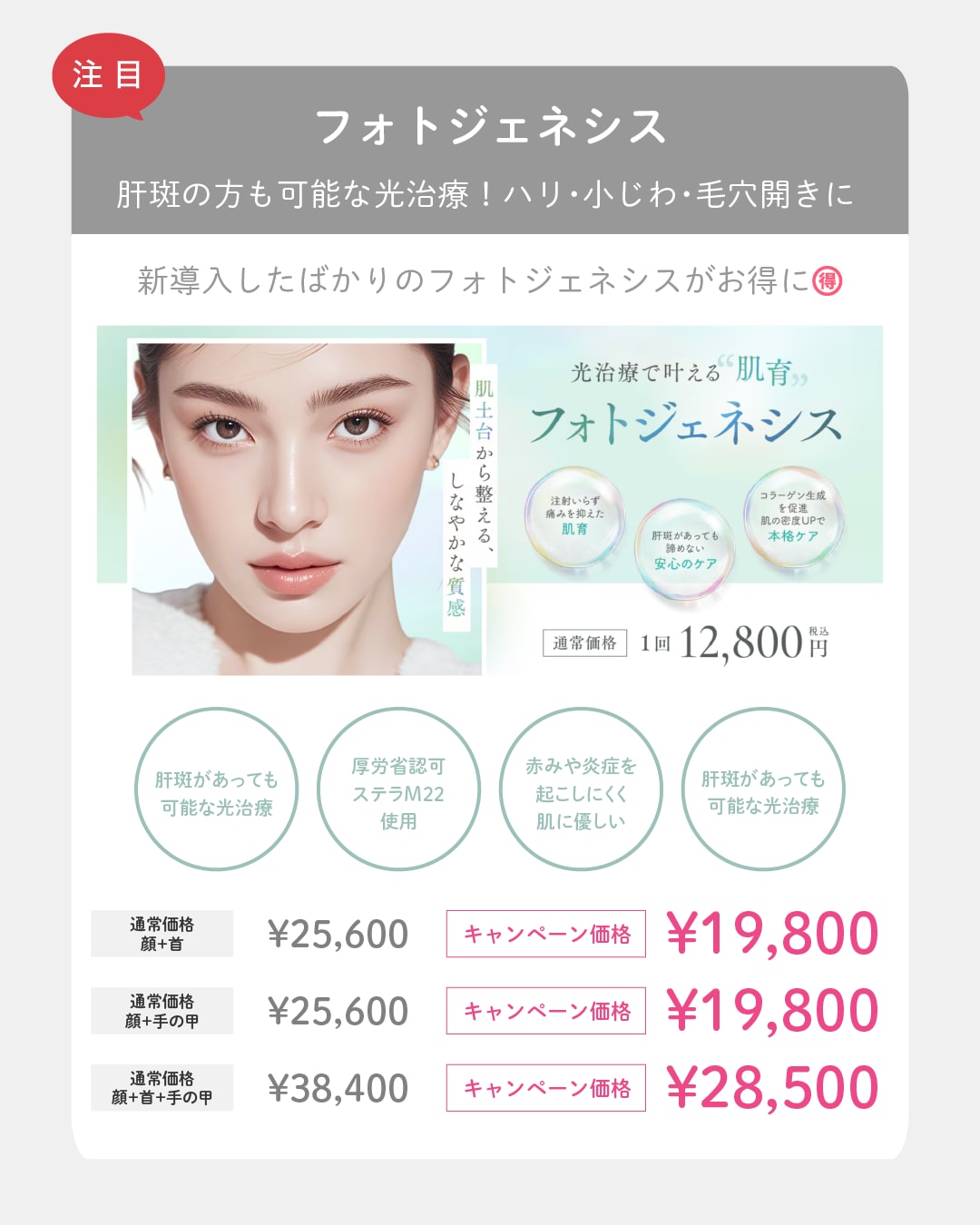 フォトジェネシス