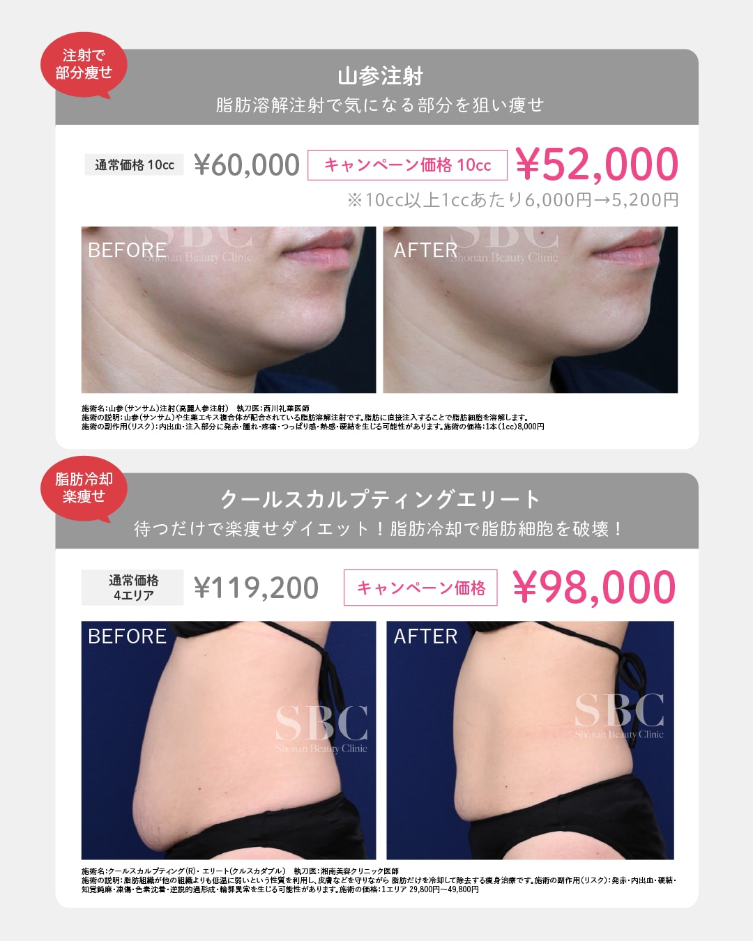 医療ダイエット