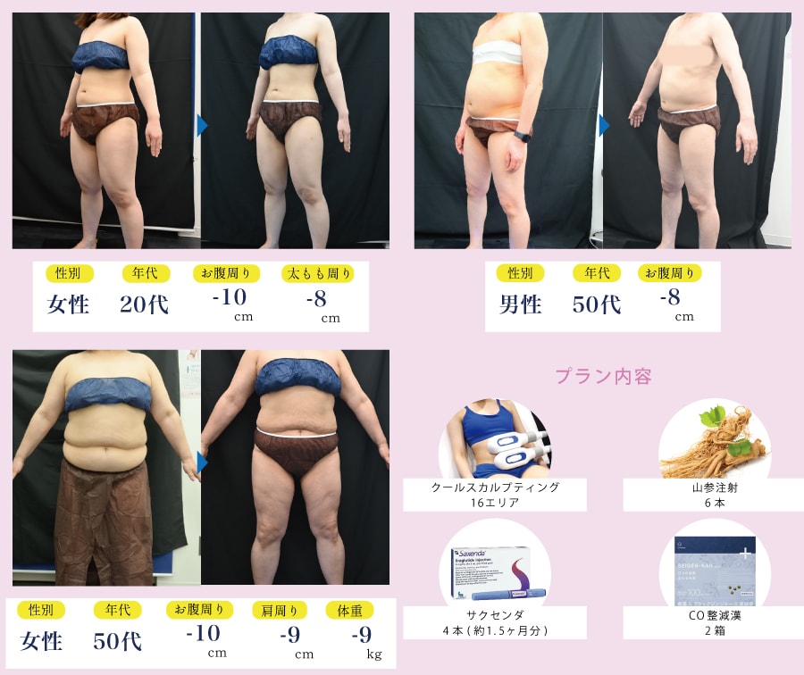 全身本気痩せプラン